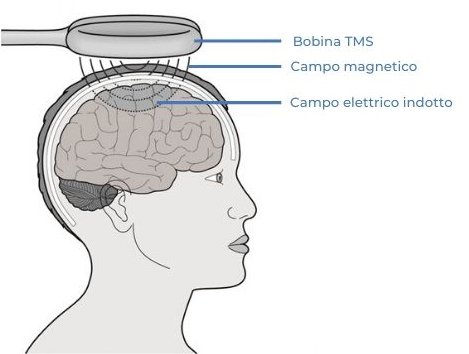 tms-stimolazione-magnetica-transcranica